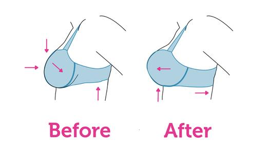 Are size G breasts supposed to be pushed out towards your armpits? :  r/ABraThatFits
